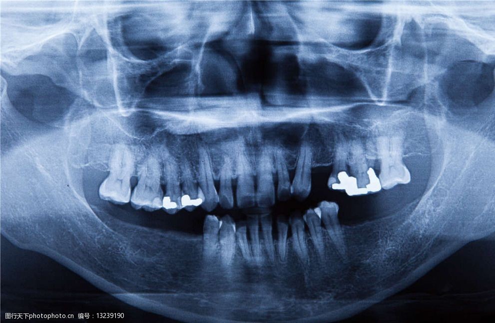 关键词:口腔x光片 口腔 牙齿 x光 透视 医疗 ct x光片 核磁共振 医疗