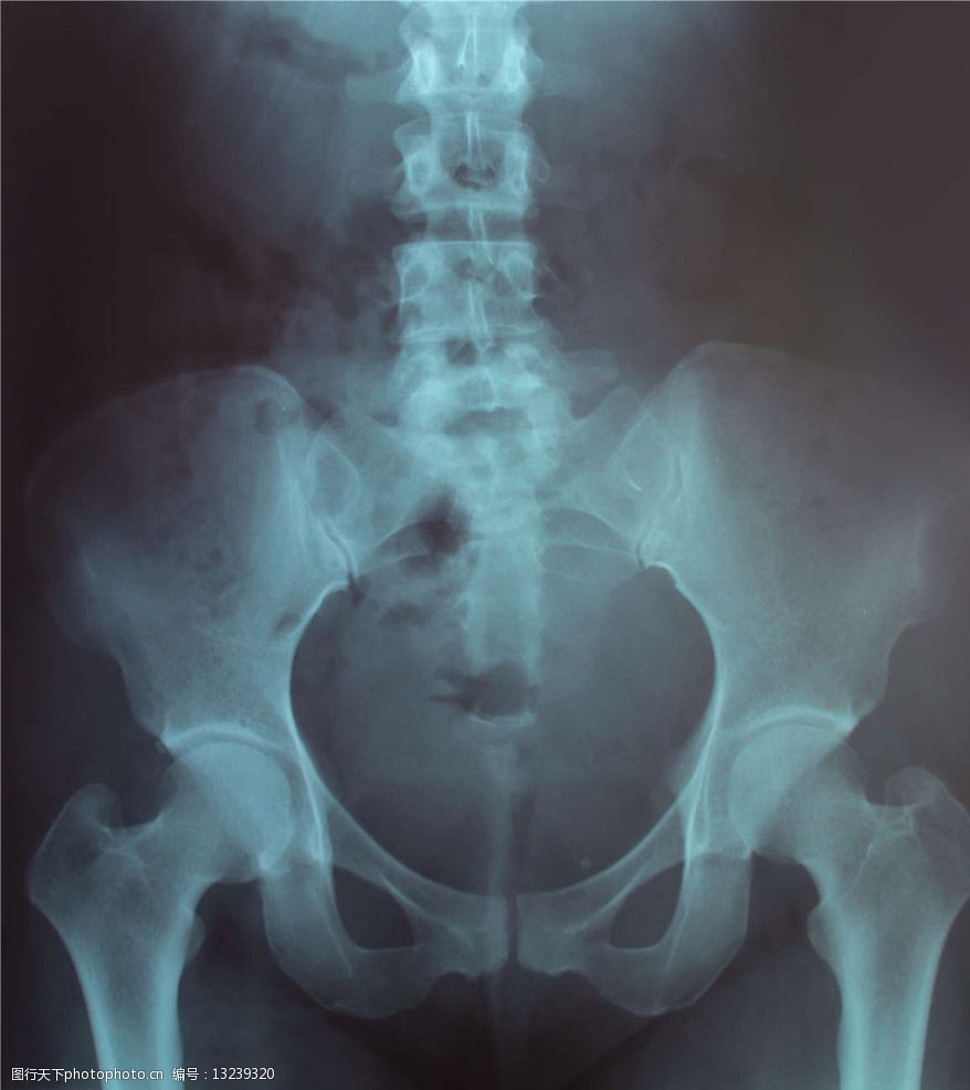 正常的女性骨盆x光片图片